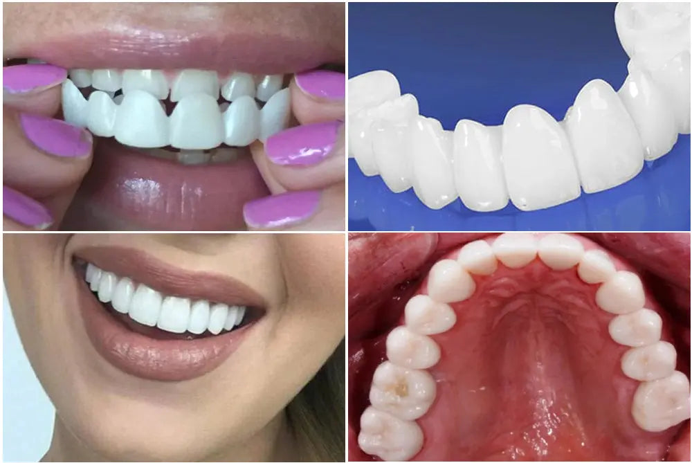 Regulowane soczewki dentystyczne Kup 1, Otrzymaj 2 Marlene Polônia Dente 2